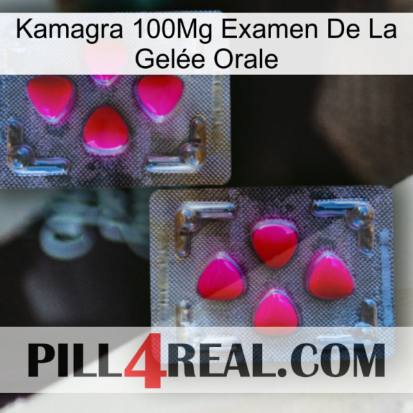 Kamagra 100Mg Examen De La Gelée Orale 15.jpg